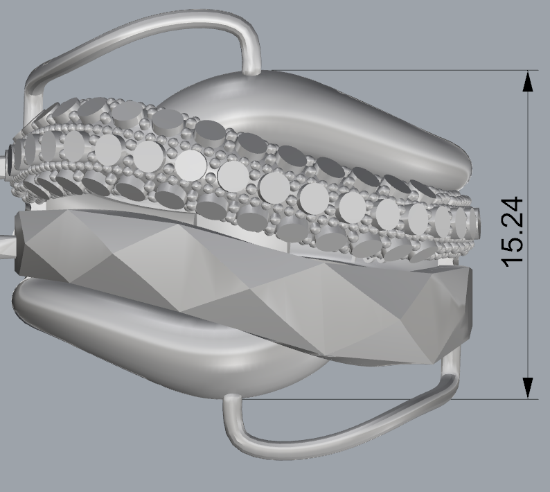 Ring 17